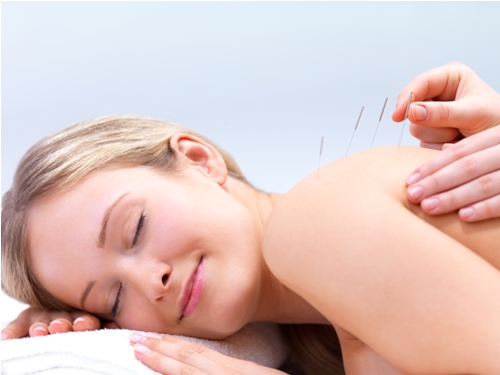 Acupuncture Treatment